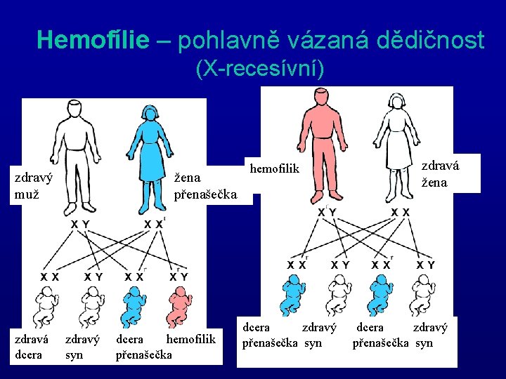 Hemofílie – pohlavně vázaná dědičnost (X-recesívní) zdravý muž zdravá dcera žena přenašečka zdravý syn