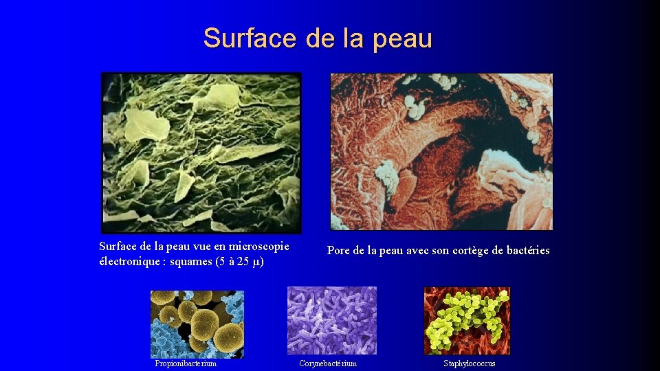 Surface de la peau vue en microscopie électronique : squames (5 à 25 µ)