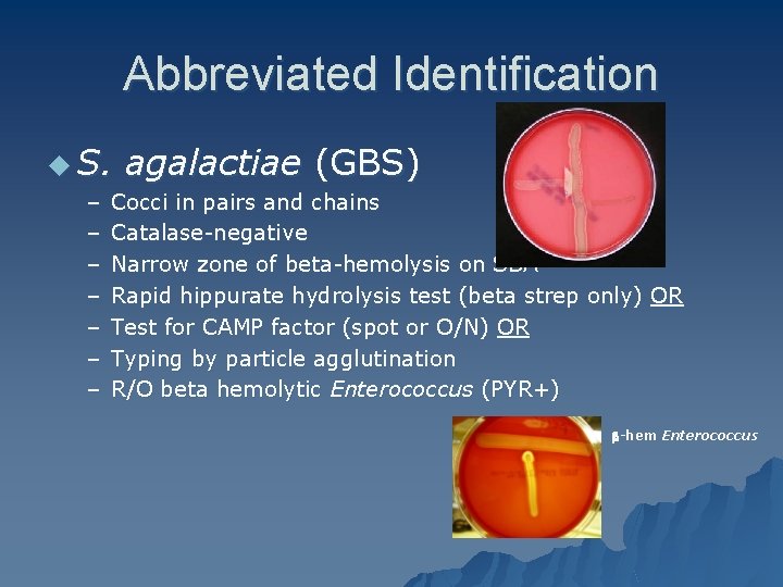 Abbreviated Identification u S. – – – – agalactiae (GBS) Cocci in pairs and