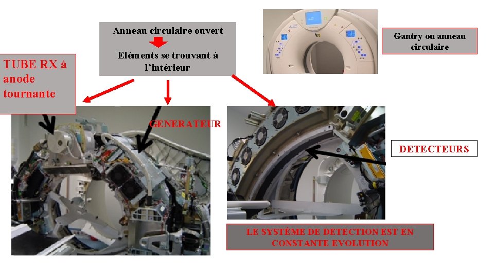 Anneau circulaire ouvert TUBE RX à anode tournante Eléments se trouvant à l’intérieur Gantry