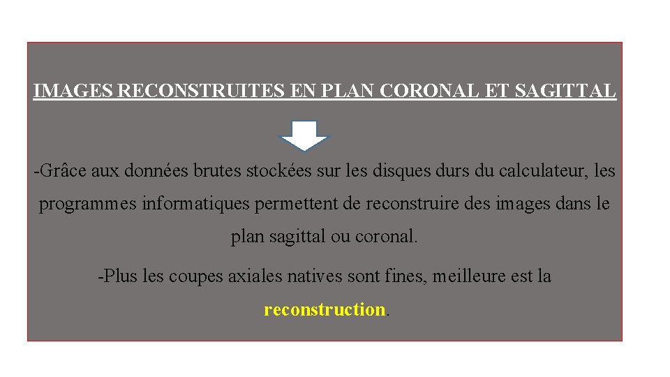 IMAGES RECONSTRUITES EN PLAN CORONAL ET SAGITTAL -Grâce aux données brutes stockées sur les