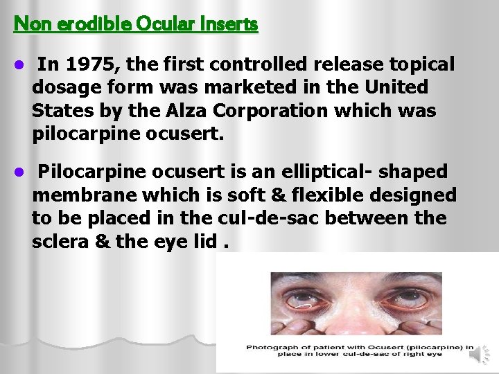 Non erodible Ocular Inserts l In 1975, the first controlled release topical dosage form