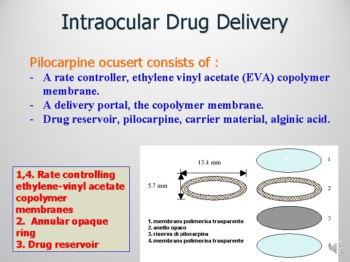 Intraocular Drug Delivery Pilocarpine ocusert consists of : - A rate controller, ethylene vinyl