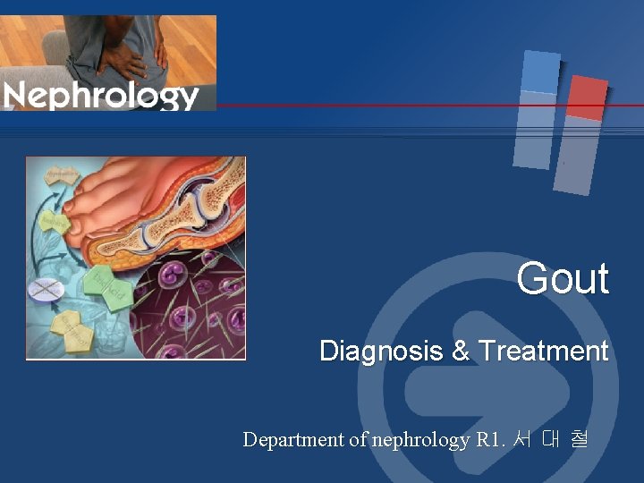 Gout Diagnosis & Treatment Department of nephrology R 1. 서 대 철 