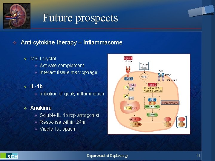 Future prospects v Anti-cytokine therapy – Inflammasome v MSU crystal v Activate complement v