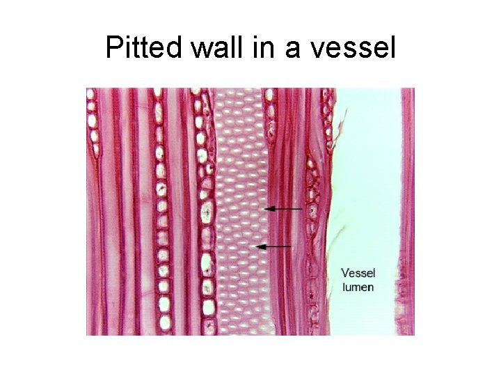 Pitted wall in a vessel 