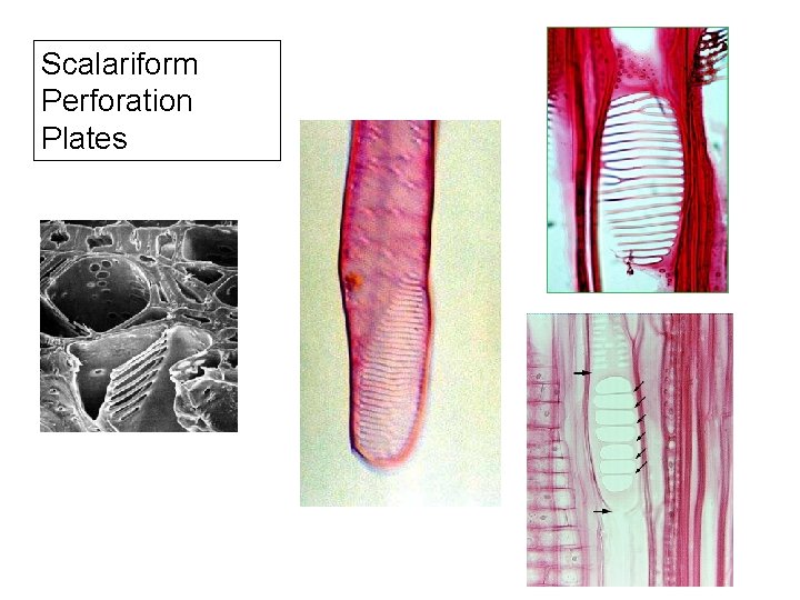 Scalariform Perforation Plates 