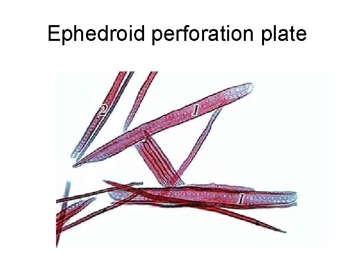 Ephedroid perforation plate 