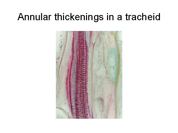 Annular thickenings in a tracheid 