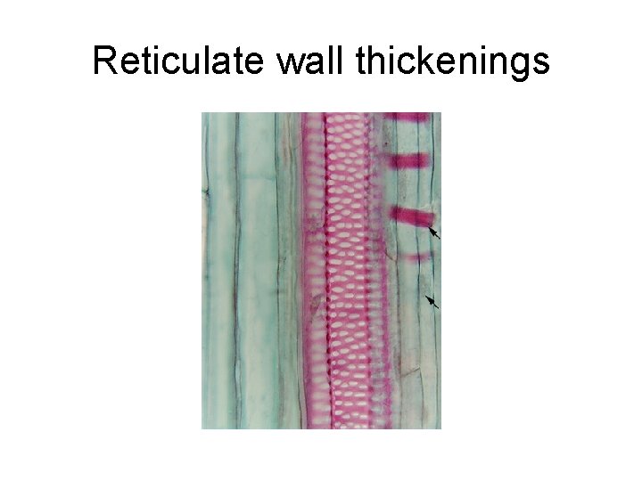 Reticulate wall thickenings 