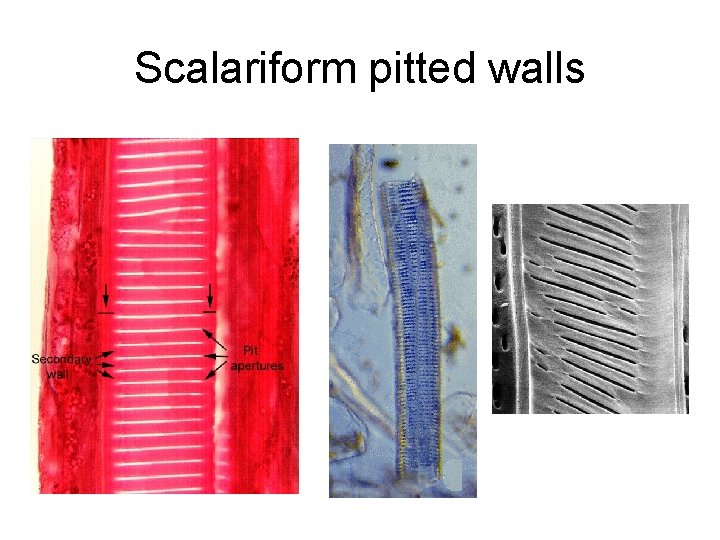 Scalariform pitted walls 
