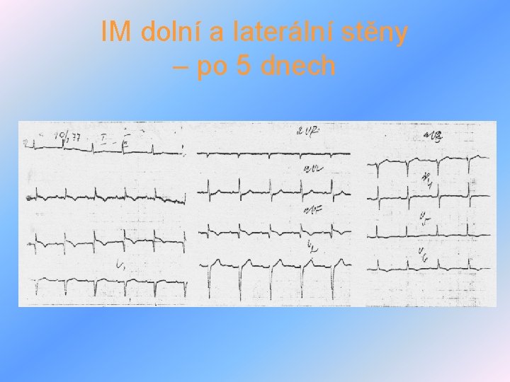 IM dolní a laterální stěny – po 5 dnech 