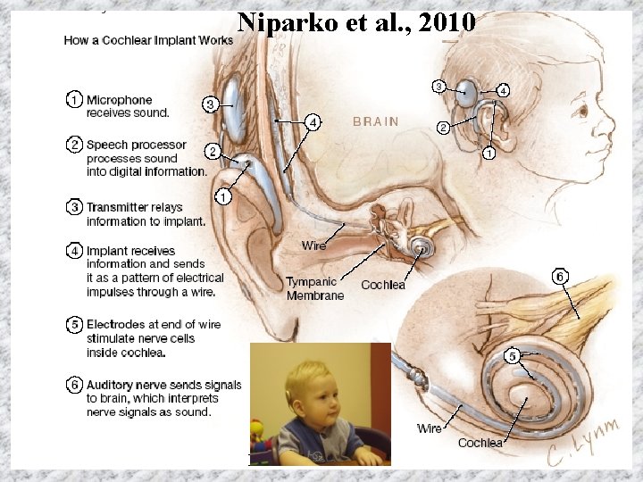 Niparko et al. , 2010 Romero 