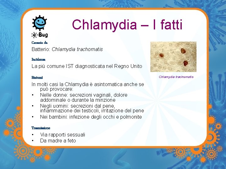 Chlamydia – I fatti Causata da Batterio: Chlamydia trachomatis Incidenza La più comune IST