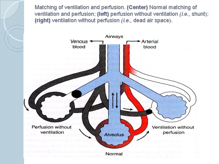 Matching of ventilation and perfusion. (Center) Normal matching of ventilation and perfusion; (left) perfusion