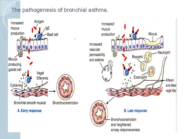 The pathogenesis of bronchial asthma. 