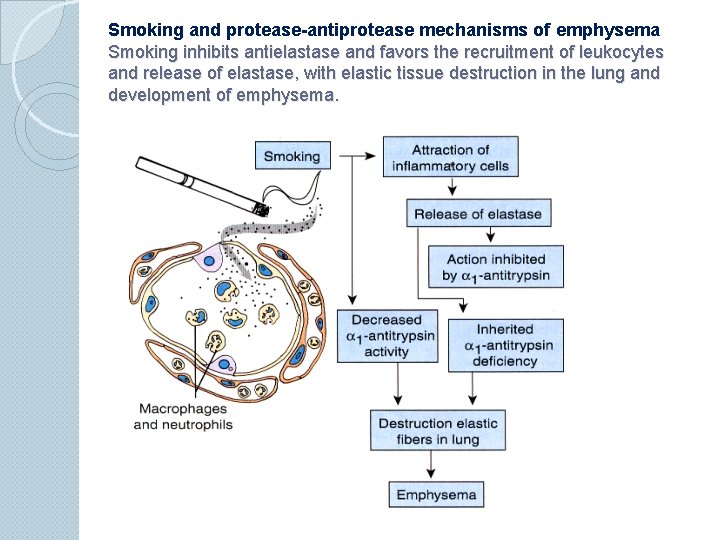 Smoking and protease-antiprotease mechanisms of emphysema Smoking inhibits antielastase and favors the recruitment of