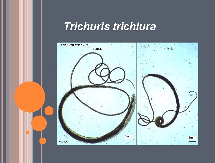 Trichuris trichiura 