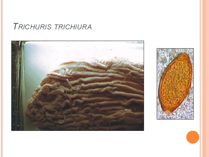 TRICHURIS TRICHIURA 