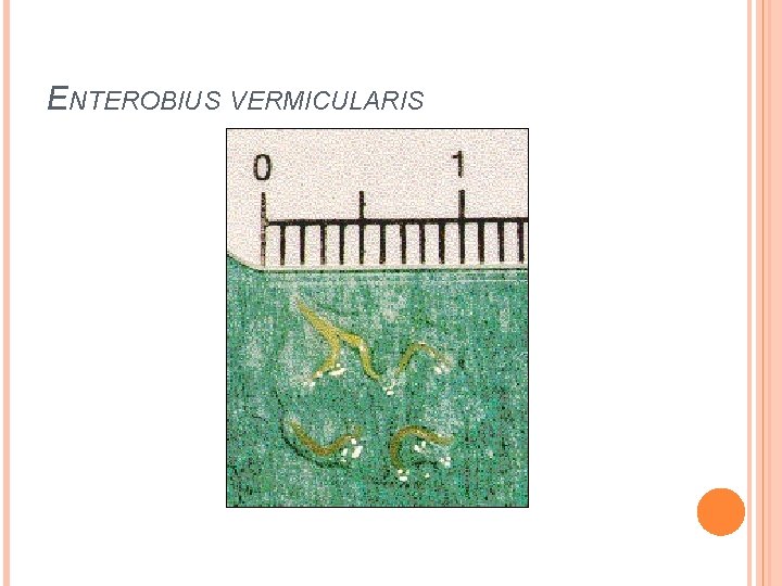 ENTEROBIUS VERMICULARIS 