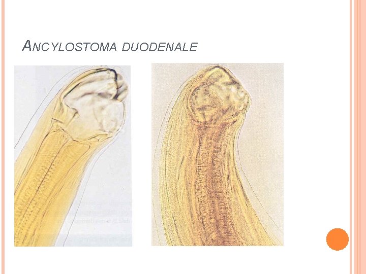 ANCYLOSTOMA DUODENALE 