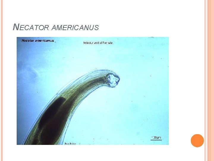 NECATOR AMERICANUS 