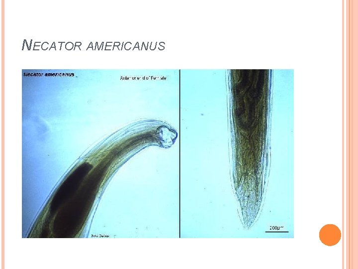 NECATOR AMERICANUS 