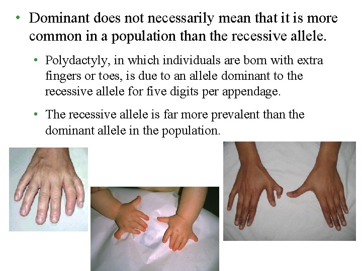  • Dominant does not necessarily mean that it is more common in a