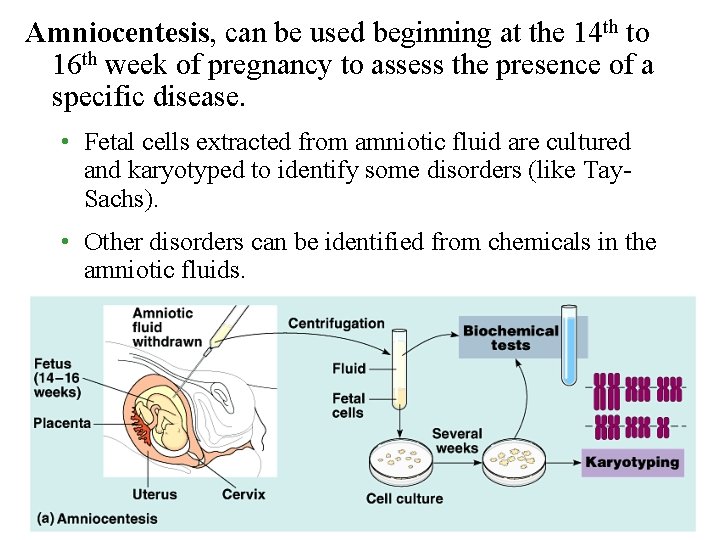 Amniocentesis, can be used beginning at the 14 th to 16 th week of