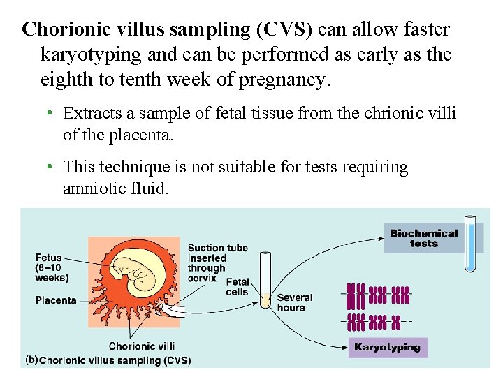 Chorionic villus sampling (CVS) can allow faster karyotyping and can be performed as early