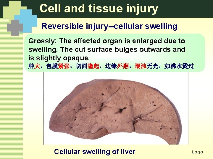 Cell and tissue injury Reversible injury--cellular swelling Grossly: The affected organ is enlarged due