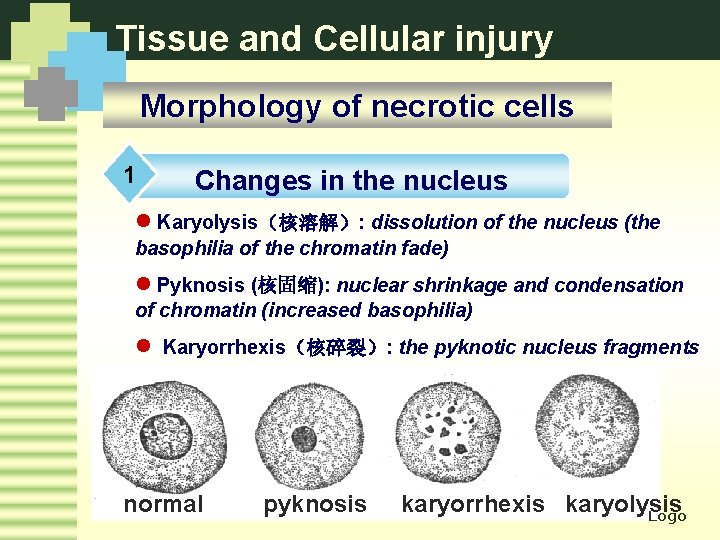 Tissue and Cellular injury Morphology of necrotic cells 1 Changes in the nucleus l