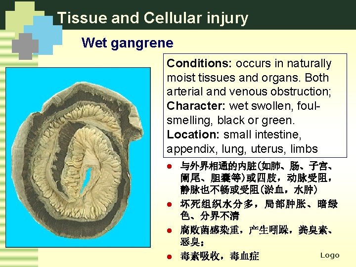 Tissue and Cellular injury Wet gangrene Conditions: occurs in naturally moist tissues and organs.