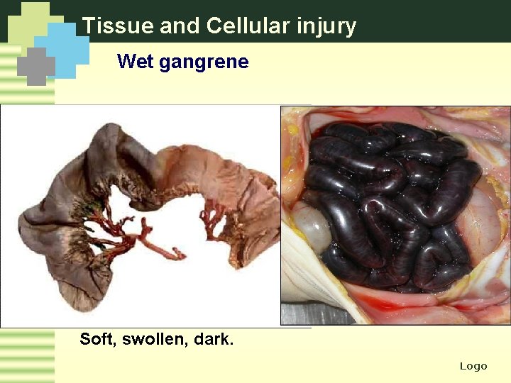 Tissue and Cellular injury Wet gangrene Soft, swollen, dark. Logo 
