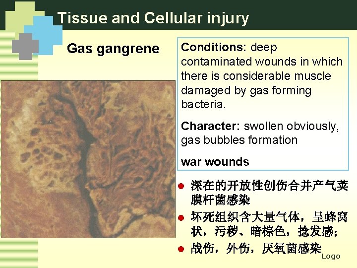 Tissue and Cellular injury Gas gangrene Conditions: deep contaminated wounds in which there is