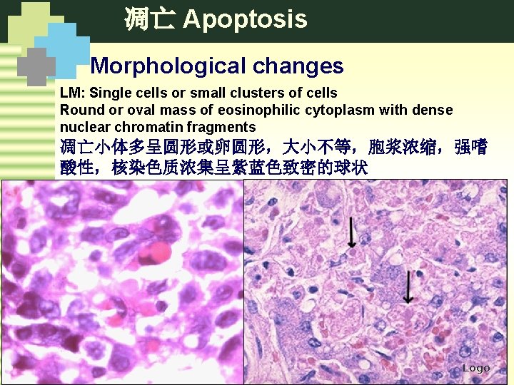 凋亡 Apoptosis Morphological changes LM: Single cells or small clusters of cells Round or