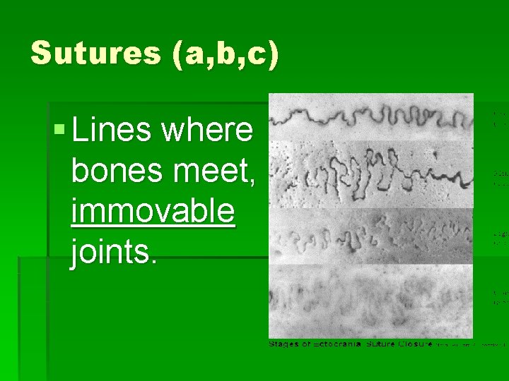 Sutures (a, b, c) § Lines where bones meet, immovable joints. 