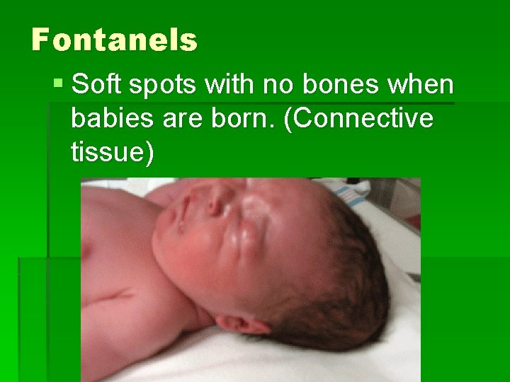 Fontanels § Soft spots with no bones when babies are born. (Connective tissue) 