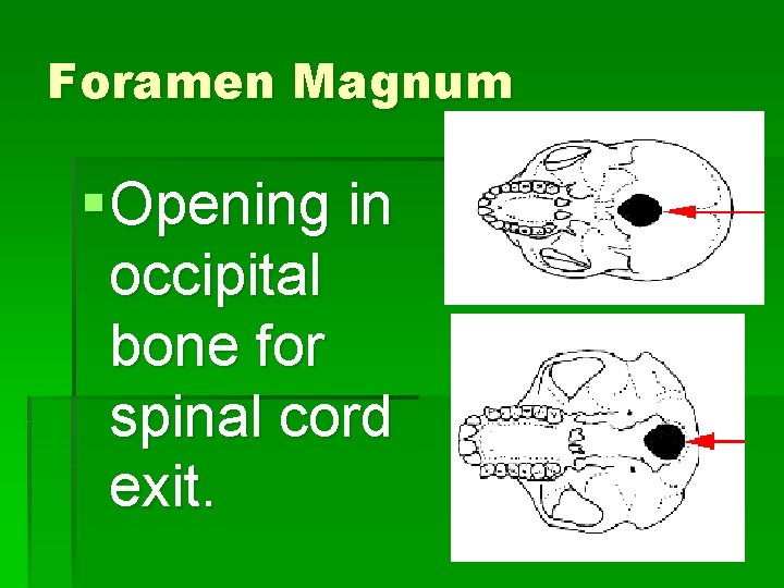 Foramen Magnum § Opening in occipital bone for spinal cord exit. 