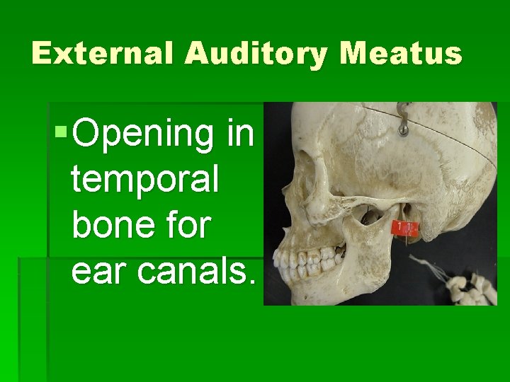 External Auditory Meatus § Opening in temporal bone for ear canals. 