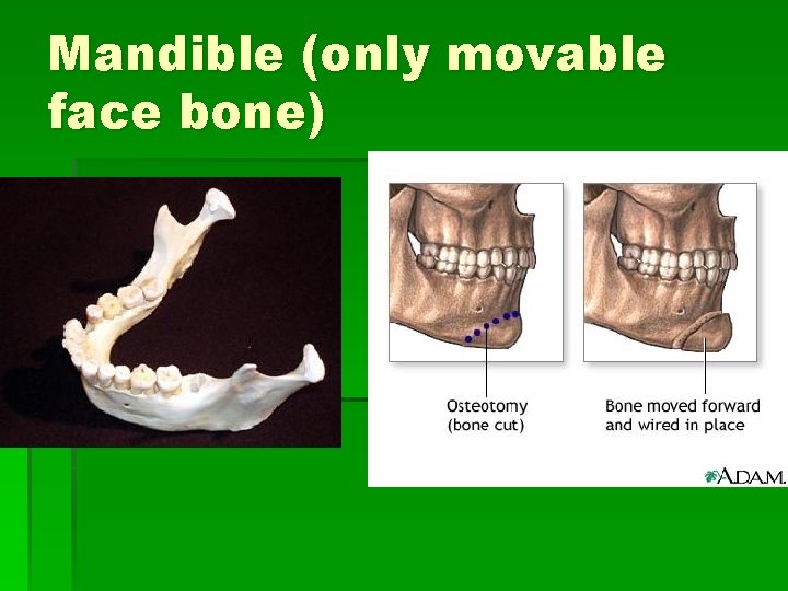 Mandible (only movable face bone) 