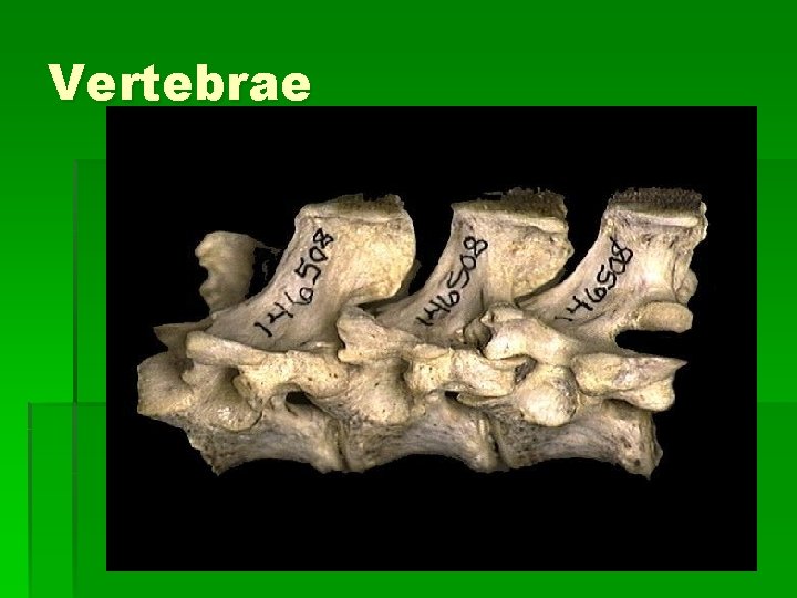 Vertebrae 