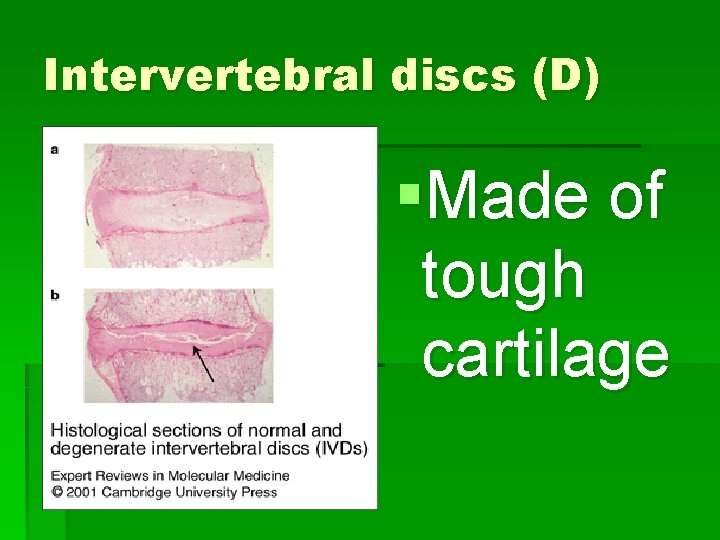 Intervertebral discs (D) §Made of tough cartilage 