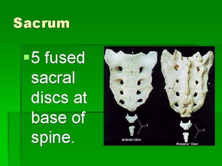 Sacrum § 5 fused sacral discs at base of spine. 