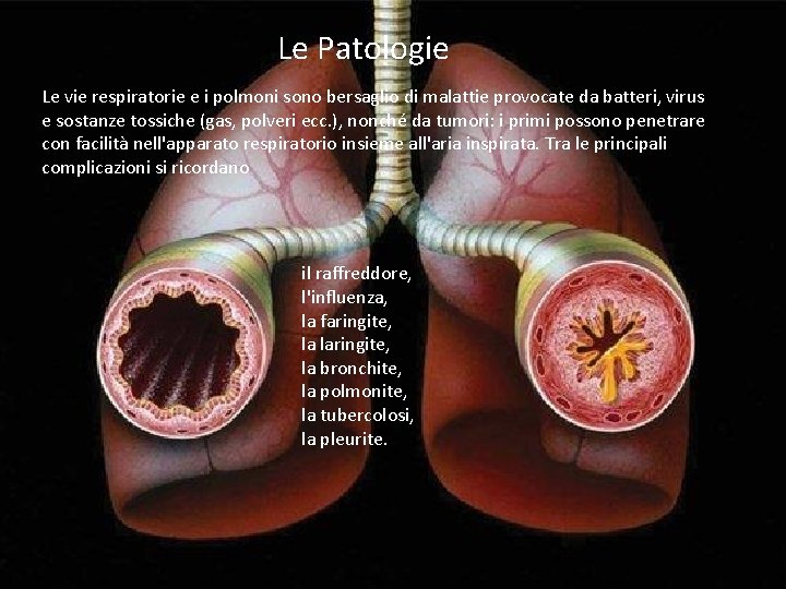 Le Patologie Le vie respiratorie e i polmoni sono bersaglio di malattie provocate da