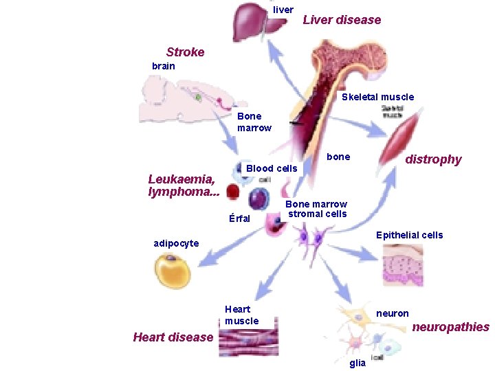 liver Liver disease Stroke brain Skeletal muscle Bone marrow bone Leukaemia, lymphoma. . .