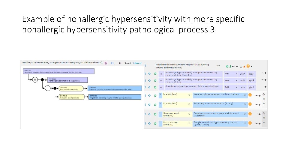 Example of nonallergic hypersensitivity with more specific nonallergic hypersensitivity pathological process 3 