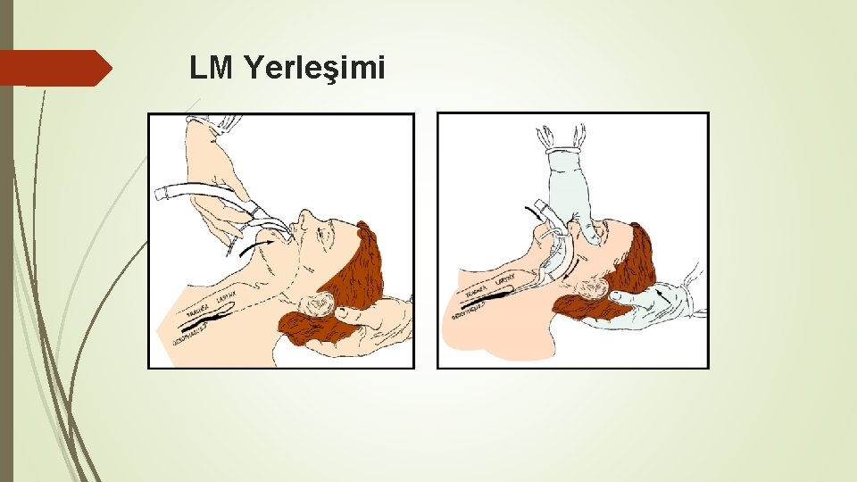 LM Yerleşimi 