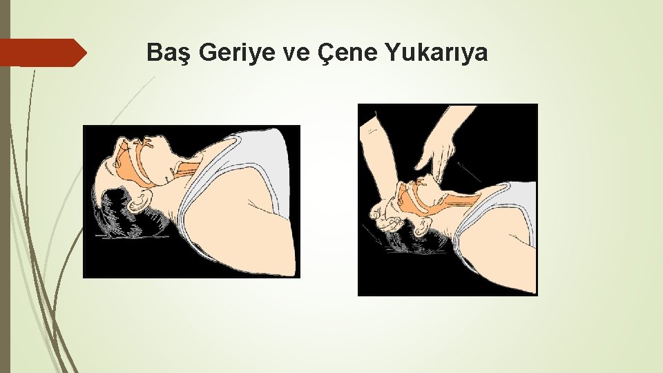 Baş Geriye ve Çene Yukarıya 