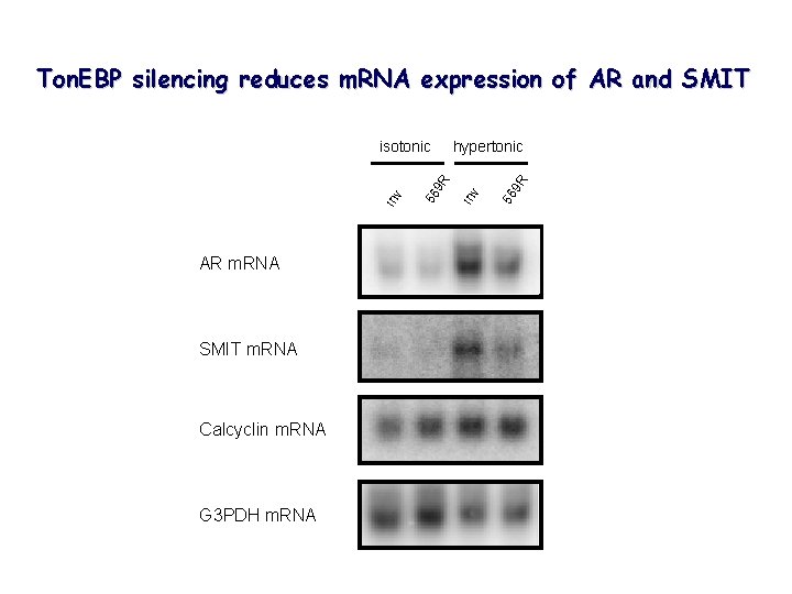 Ton. EBP silencing reduces m. RNA expression of AR and SMIT AR m. RNA